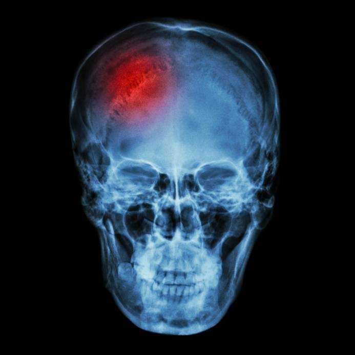 CT Scan Upload illustration